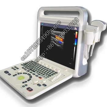 Полноцифровая Цветен Доплер система XF3600V Цена машини за ветеринарни прилагане на Преносим ултразвук